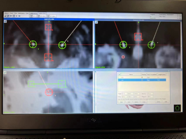 图片1_副本.png 图片1_副本.png